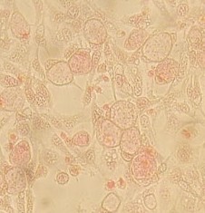 Immunohistochemistry (Formalin/PFA-fixed paraffin-embedded sections) - Native Chlamydia trachomatis protein (AB123998), expandable thumbnail