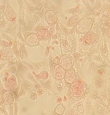 Immunohistochemistry (Formalin/PFA-fixed paraffin-embedded sections) - Native Chlamydia trachomatis protein (AB123998)