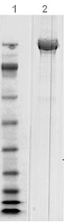 SDS-PAGE - Native Clostridium difficile Toxoid B protein (AB124002), expandable thumbnail