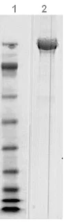 SDS-PAGE - Native Clostridium difficile Toxoid B protein (AB124002)