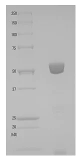 SDS-PAGE - Native Diphtheria Toxin (mutated G52E) protein (AB188505)