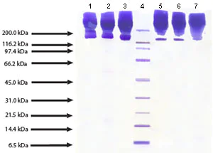 SDS-PAGE - Native Human Apolipoprotein B (AB91112)