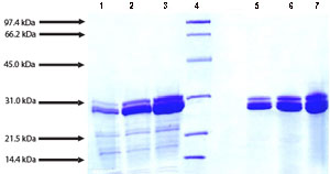 Native human Cathepsin G protein