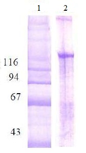 SDS-PAGE - Native Human Collagen II protein (AB134522)