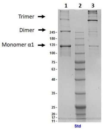SDS-PAGE - Native Human Collagen III protein (AB7535), expandable thumbnail