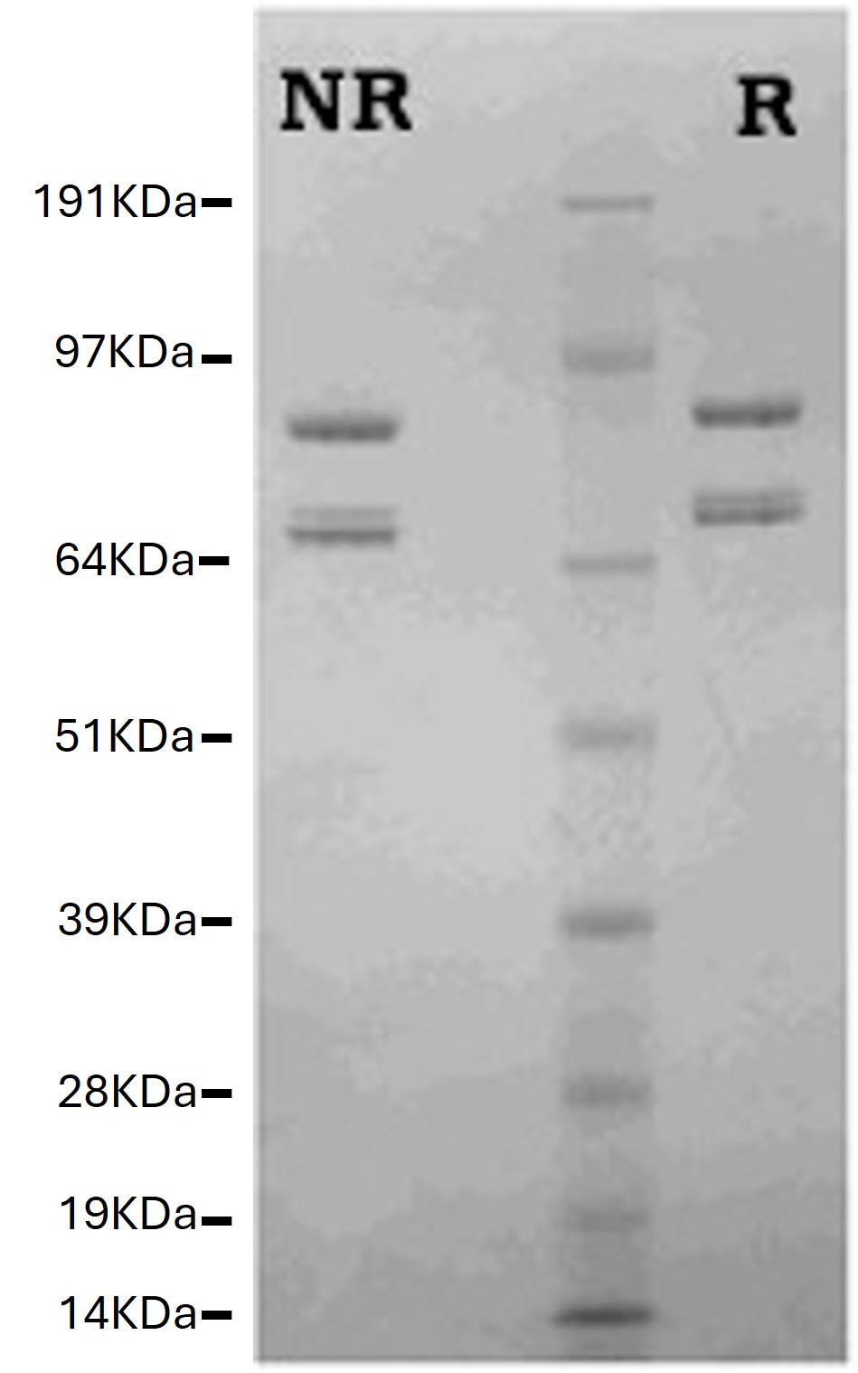 SDS-PAGE - Native Human Factor Va protein (AB62415)