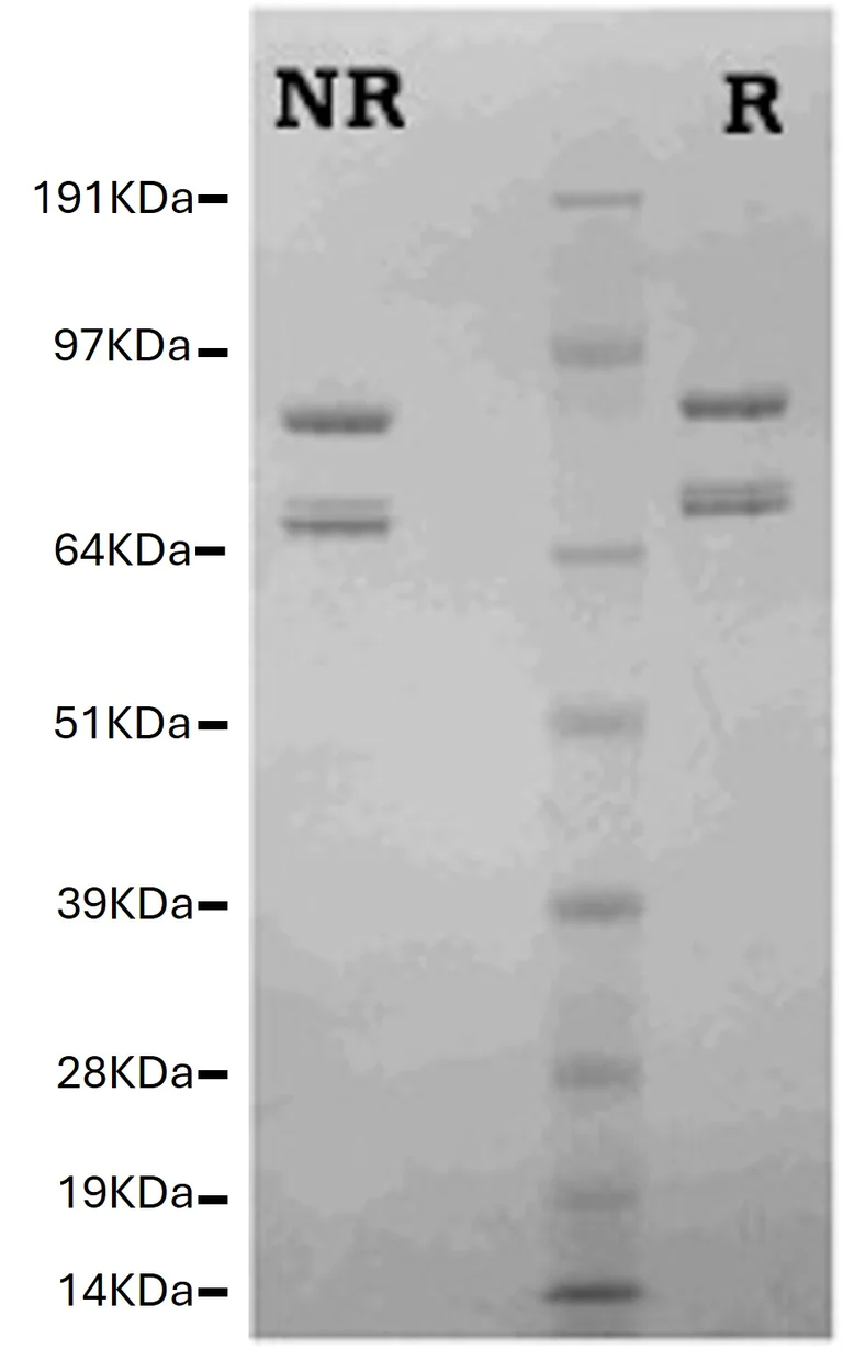 SDS-PAGE - Native Human Factor Va protein (AB62415)