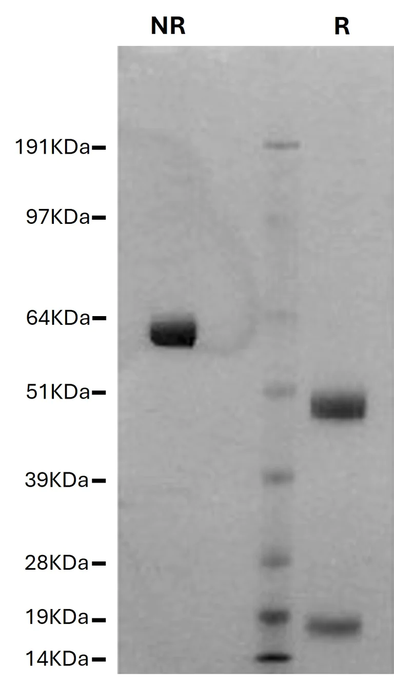 SDS-PAGE - Native Human Factor X protein (AB62549)