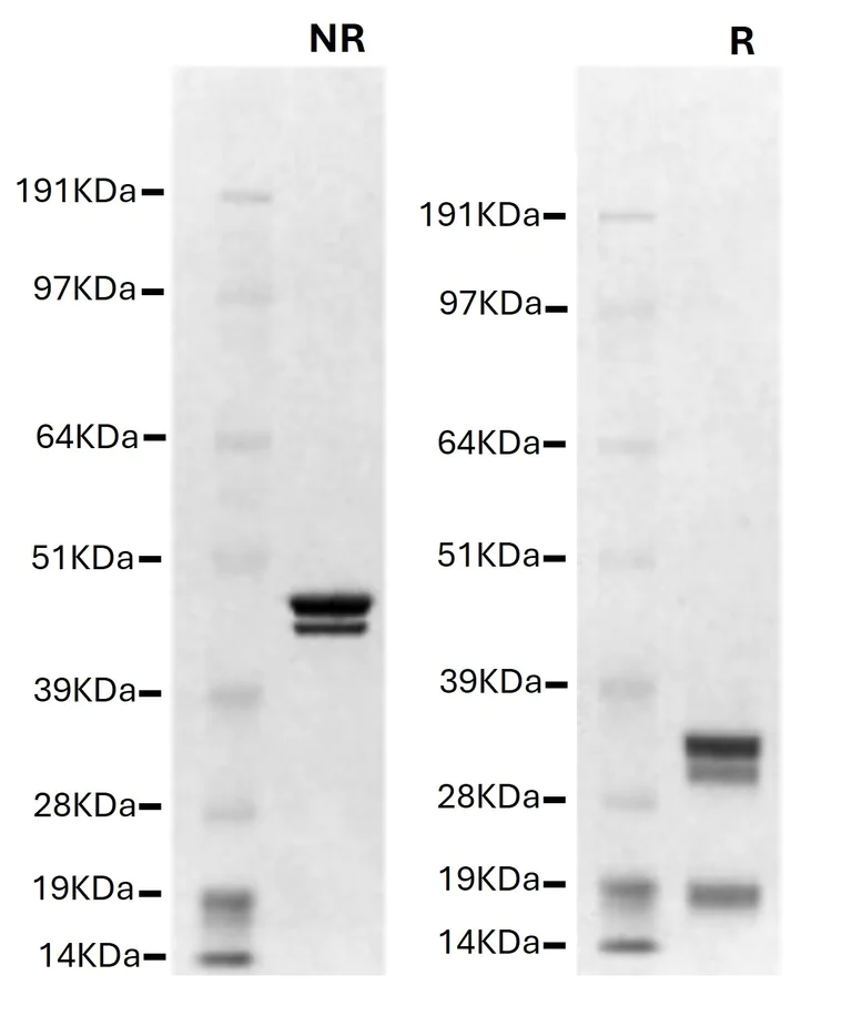 SDS-PAGE - Native human Factor Xa (AB62229)
