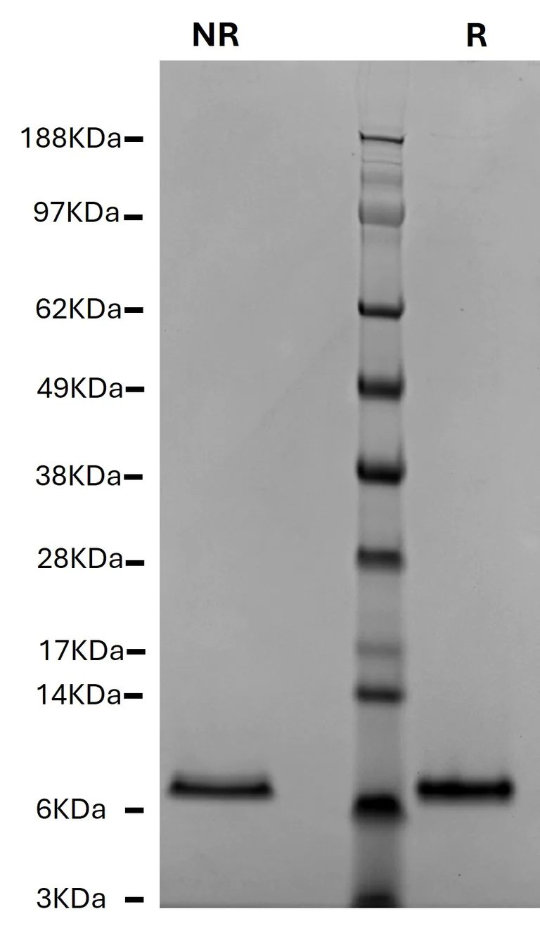 SDS-PAGE - Native human PF4 protein (AB81754)