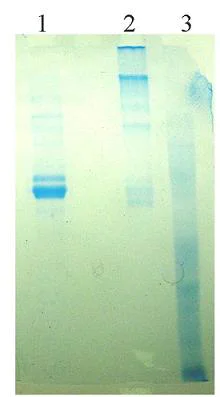 SDS-PAGE - Native Human Vitronectin/S-Protein (AB92683)