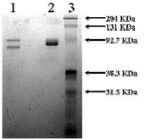 SDS-PAGE - Native Human Vitronectin/S-Protein (Biotin) (AB92639), expandable thumbnail