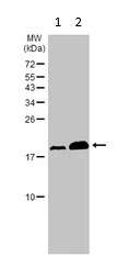 Western blot - Anti-Natriuretic peptides A antibody (AB126149)