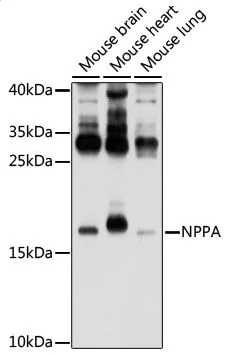 Western blot - Anti-Natriuretic peptides A antibody (AB180649)