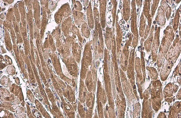 Immunohistochemistry (Formalin/PFA-fixed paraffin-embedded sections) - Anti-Natriuretic peptides A antibody (AB262703)