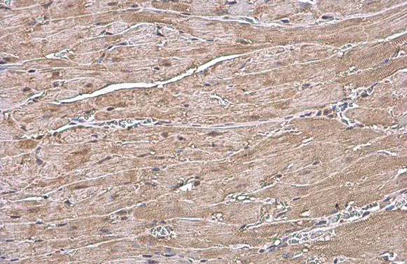 Immunohistochemistry (Formalin/PFA-fixed paraffin-embedded sections) - Anti-Natriuretic peptides A antibody (AB262703)
