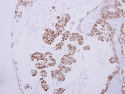 Immunohistochemistry (Formalin/PFA-fixed paraffin-embedded sections) - Anti-Natriuretic peptides A antibody (AB262703)