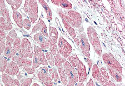 Immunohistochemistry (Formalin/PFA-fixed paraffin-embedded sections) - Anti-Natriuretic peptides A antibody - C-terminal (AB190001), expandable thumbnail