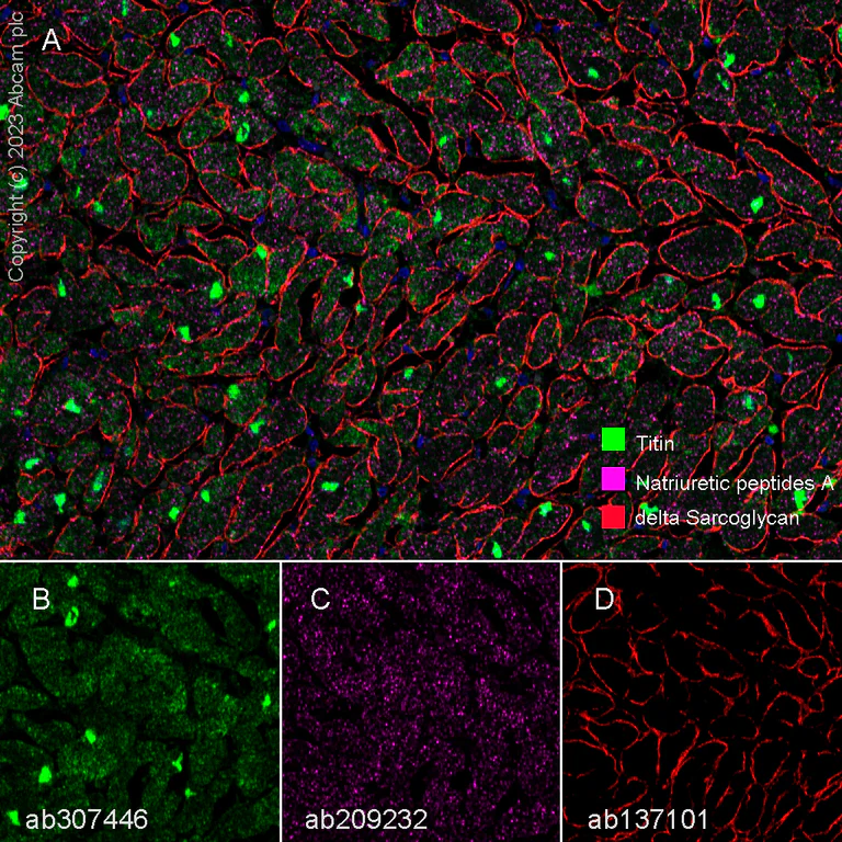 Multiplex immunohistochemistry - Anti-Natriuretic peptides A antibody [EPR20247] (AB209232)
