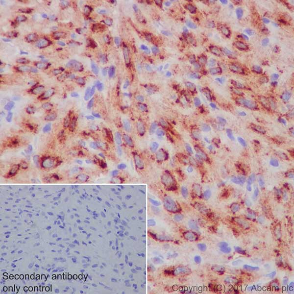 Immunohistochemistry (Formalin/PFA-fixed paraffin-embedded sections) - Anti-Natriuretic peptides A antibody [EPR20247] - BSA and Azide free (AB225873), expandable thumbnail