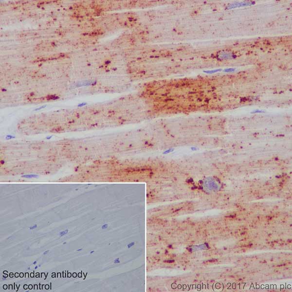 Immunohistochemistry (Formalin/PFA-fixed paraffin-embedded sections) - Anti-Natriuretic peptides A antibody [EPR20247] - BSA and Azide free (AB225873), expandable thumbnail