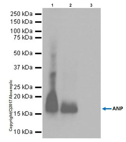Immunoprecipitation - Anti-Natriuretic peptides A antibody [EPR20247] - BSA and Azide free (AB225873), expandable thumbnail