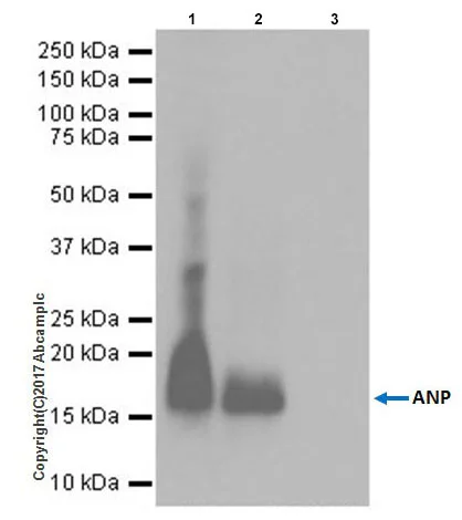 Immunoprecipitation - Anti-Natriuretic peptides A antibody [EPR20247] - BSA and Azide free (AB225873)