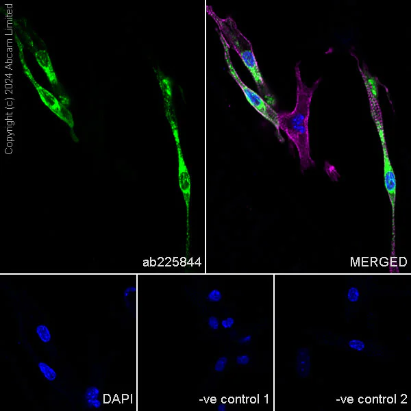Immunocytochemistry/ Immunofluorescence - Anti-Natriuretic peptides A antibody [EPR22089-283] - BSA and Azide free (AB237632)