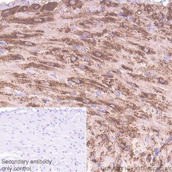 Immunohistochemistry (Formalin/PFA-fixed paraffin-embedded sections) - Anti-Natriuretic peptides A antibody [EPR22089-283] - BSA and Azide free (AB237632)