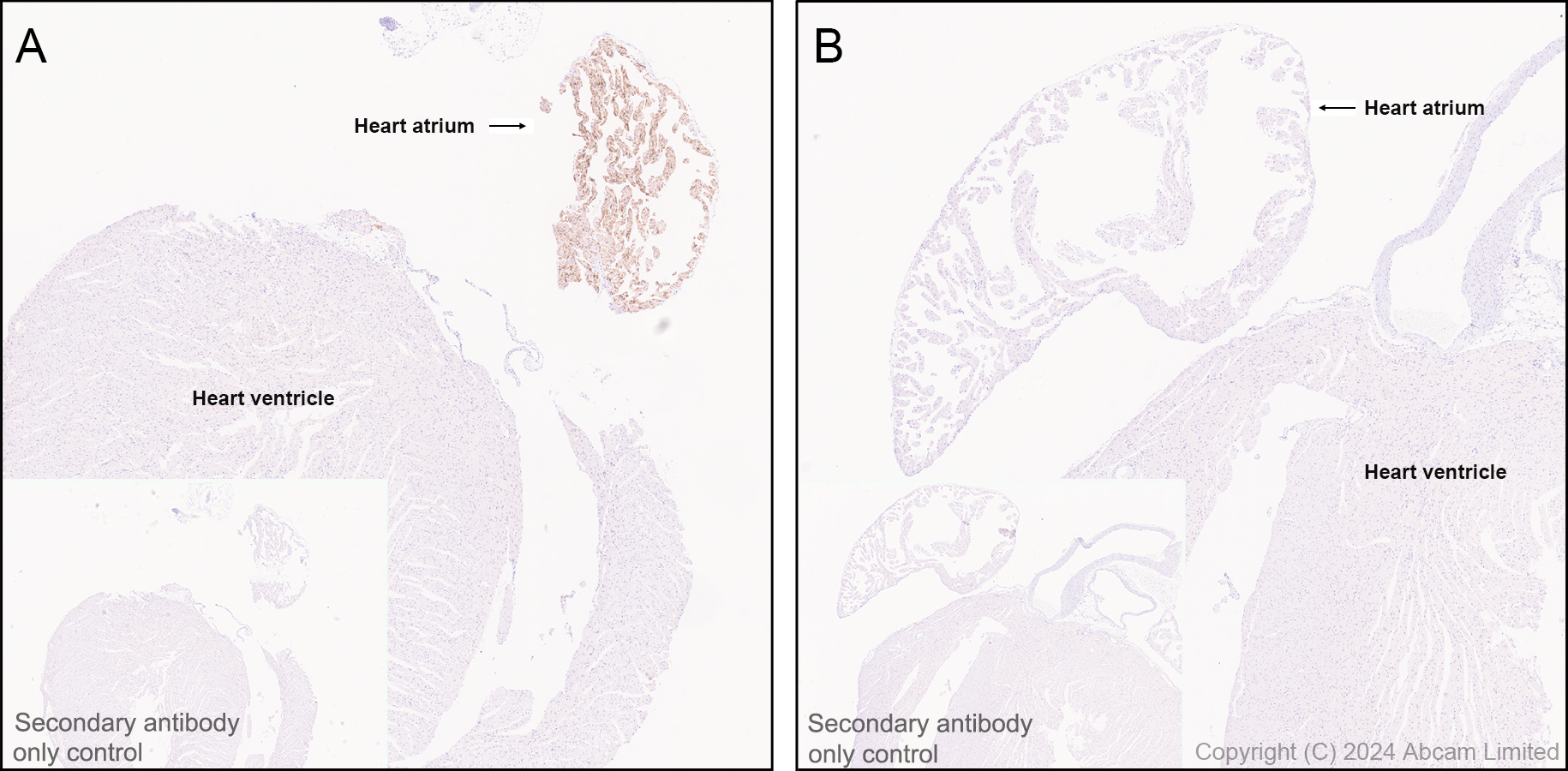 Immunohistochemistry (Formalin/PFA-fixed paraffin-embedded sections) - Anti-Natriuretic peptides A antibody [EPR22089-283] - BSA and Azide free (ab237632), expandable thumbnail