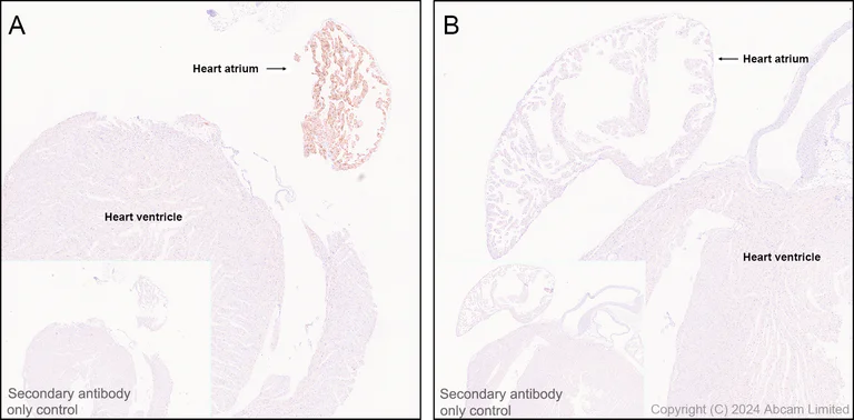 Immunohistochemistry (Formalin/PFA-fixed paraffin-embedded sections) - Anti-Natriuretic peptides A antibody [EPR22089-283] - BSA and Azide free (AB237632)