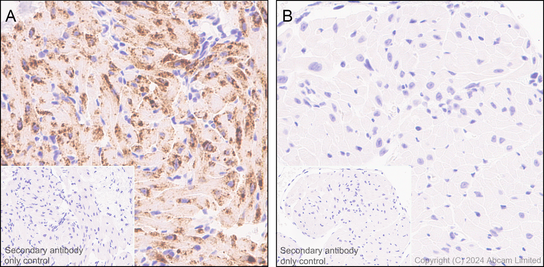 Immunohistochemistry (Formalin/PFA-fixed paraffin-embedded sections) - Anti-Natriuretic peptides A antibody [EPR22089-283] - BSA and Azide free (ab237632), expandable thumbnail