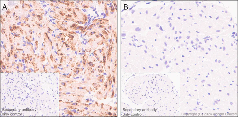 Immunohistochemistry (Formalin/PFA-fixed paraffin-embedded sections) - Anti-Natriuretic peptides A antibody [EPR22089-283] - BSA and Azide free (AB237632)