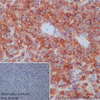 Immunohistochemistry (Formalin/PFA-fixed paraffin-embedded sections) - Natural Killer NK Cell Marker (CD3, NCAM1, CD94, NKG2D, SLAMF6, NK-p44) Antibody Panel - Human (AB254014)