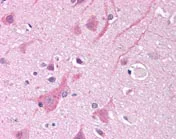 Immunohistochemistry (Formalin/PFA-fixed paraffin-embedded sections) - Anti-Nav1.5/SCN5A antibody (AB116706)