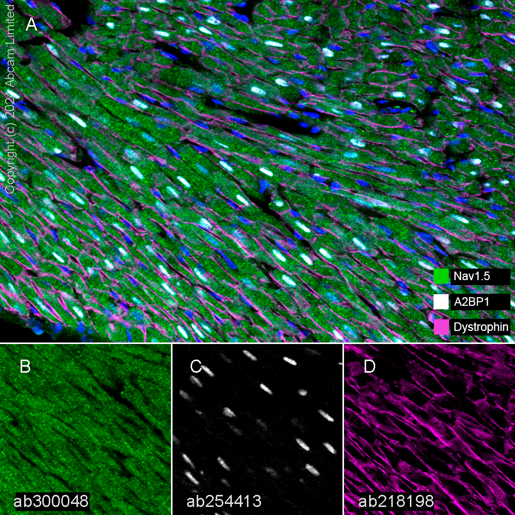 Multiplex immunohistochemistry - Anti-Nav1.5/SCN5A antibody [EPR25136-48] - BSA and Azide free (ab300049), expandable thumbnail