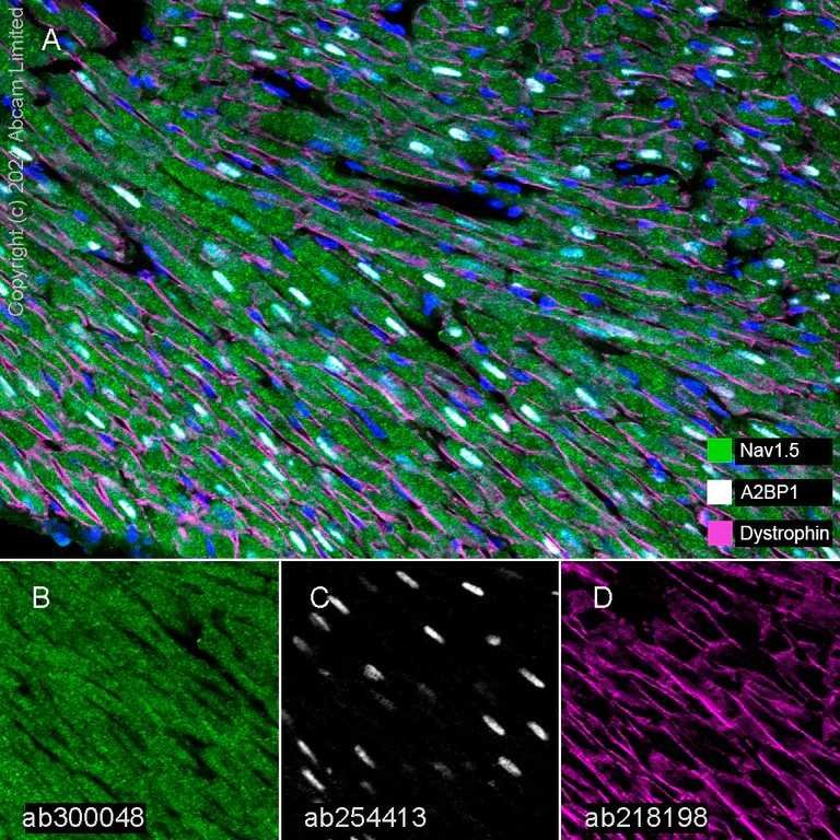 Multiplex immunohistochemistry - Anti-Nav1.5/SCN5A antibody [EPR25136-48] - BSA and Azide free (AB300049)