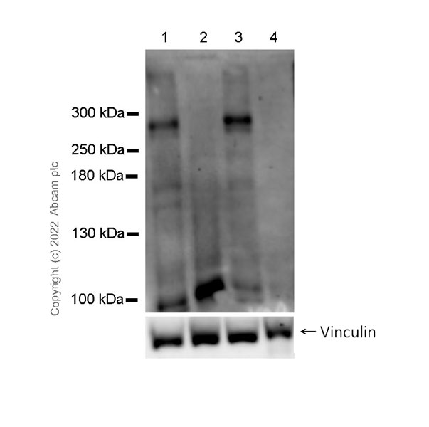 Western blot - Anti-Nav1.5/SCN5A antibody [N397/19] (AB303657), expandable thumbnail