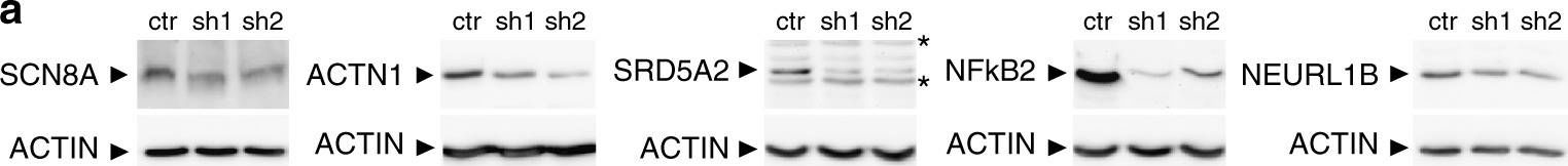 Western blot - Anti-Nav1.6/SCN8A antibody (AB65166)