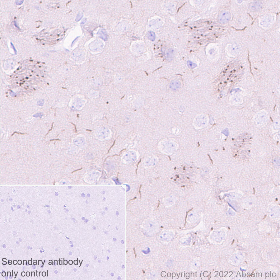 Immunohistochemistry - Anti-Nav1.6/SCN8A antibody [EPR25137-45] (ab302786), expandable thumbnail