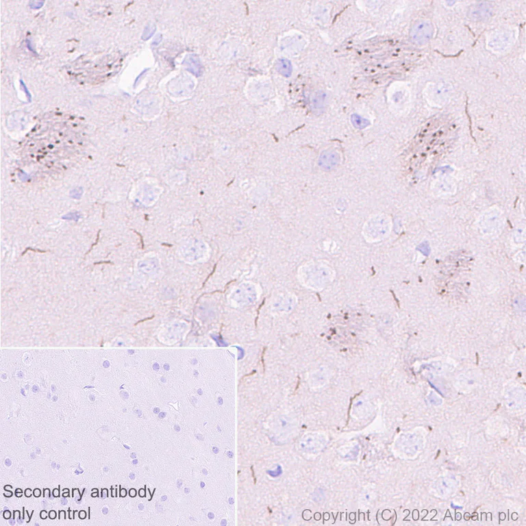 Immunohistochemistry - Anti-Nav1.6/SCN8A antibody [EPR25137-45] (AB302786)