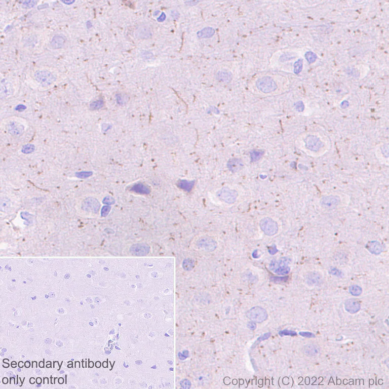 Immunohistochemistry - Anti-Nav1.6/SCN8A antibody [EPR25137-45] (AB302786)