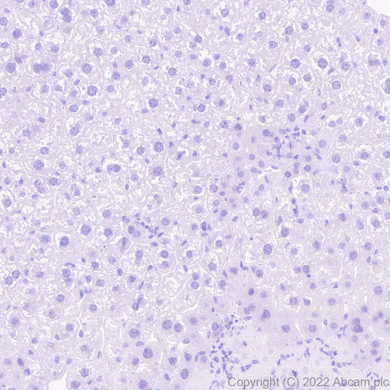 Immunohistochemistry - Anti-Nav1.6/SCN8A antibody [EPR25137-45] (AB302786)