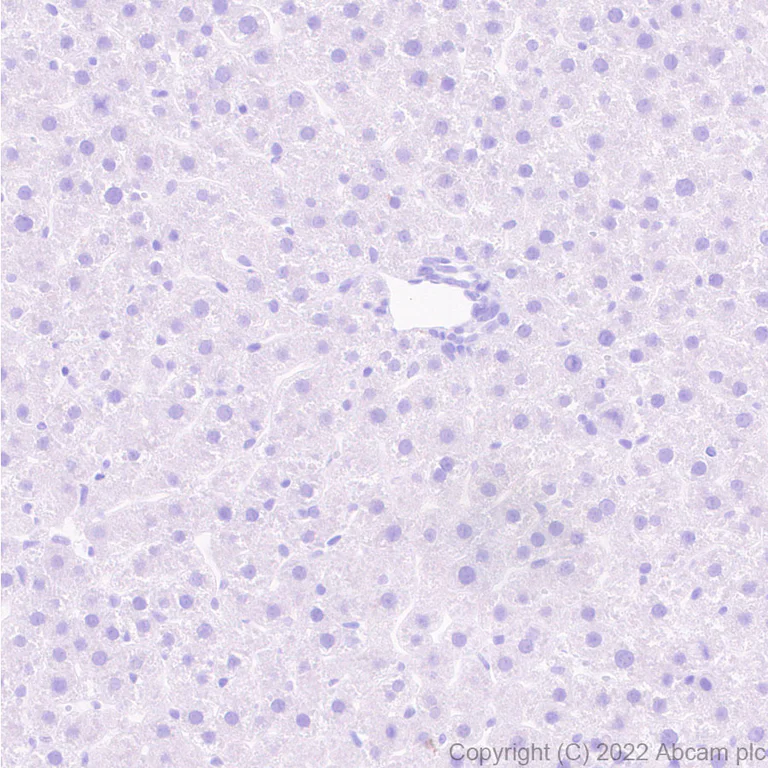 Immunohistochemistry - Anti-Nav1.6/SCN8A antibody [EPR25137-45] (AB302786)