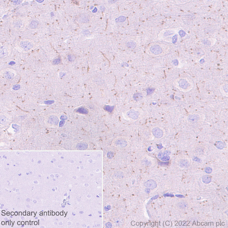 Immunohistochemistry - Anti-Nav1.6/SCN8A antibody [EPR25137-45] - BSA and Azide free (AB302787)