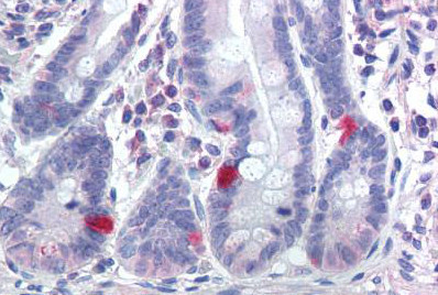 Immunohistochemistry (Formalin/PFA-fixed paraffin-embedded sections) - Anti-Nav1.7 antibody (AB140991), expandable thumbnail