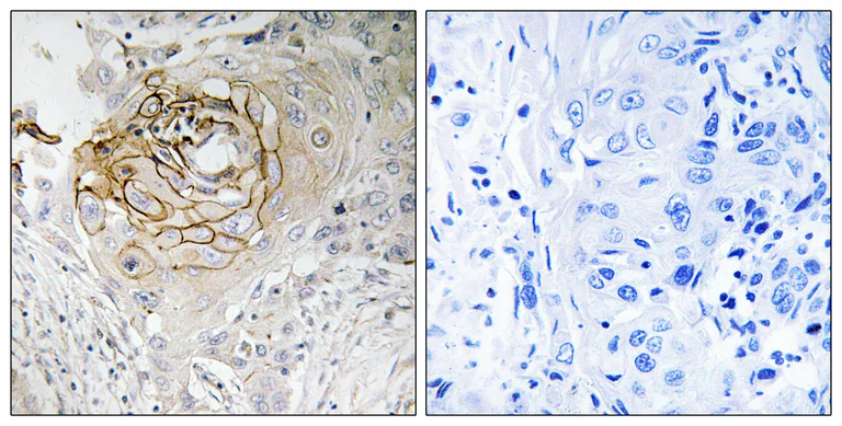 Immunohistochemistry (Formalin/PFA-fixed paraffin-embedded sections) - Anti-Nav1.7 antibody (AB196806)