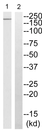 Western blot - Anti-Nav1.7 antibody (AB196806)