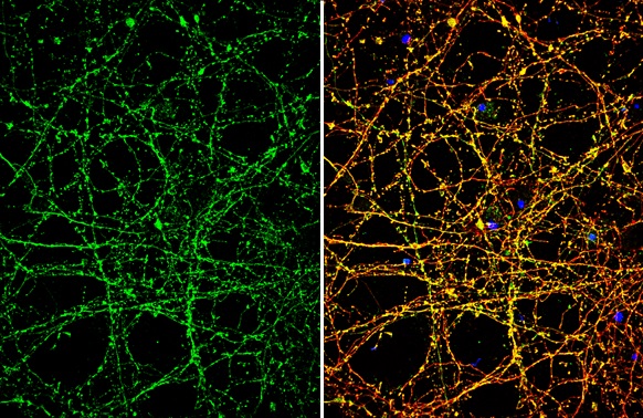 Immunocytochemistry/ Immunofluorescence - Anti-Nav1.7 antibody (AB272931), expandable thumbnail