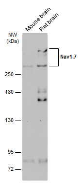Western blot - Anti-Nav1.7 antibody (AB272931), expandable thumbnail